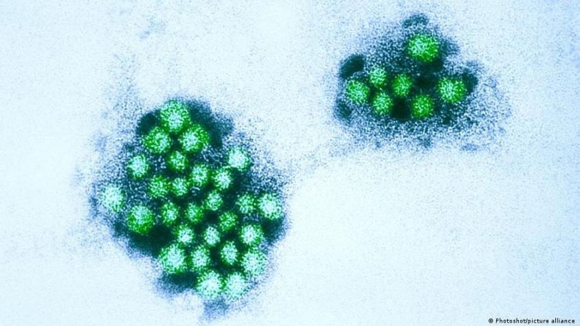 Reportan brote de norovirus en Reino Unido: qué es y cuáles son los síntomas de la infección
