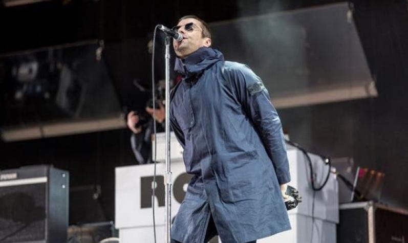 [FOTOS] Liam Gallagher sufrió heridas en su rostro luego de caerse de un helicóptero