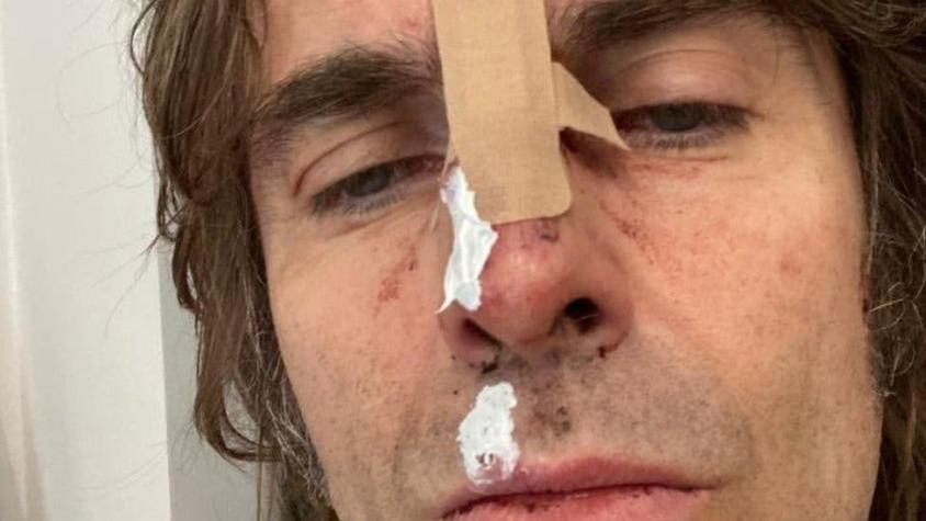 La foto que compartió Liam Gallagher, exlíder de Oasis, tras "caerse de un helicóptero"