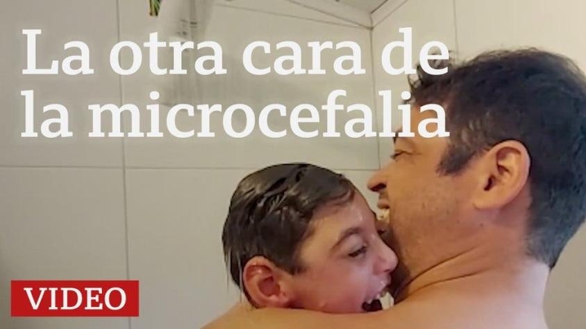 Microcefalia: La inesperada y feliz vida de una familia cinco años después del zika