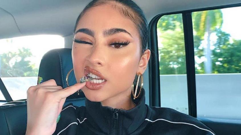 La moda de Rosalía, Paloma Mami o Kim Kardashian: expertos advierten por riesgos de "joyería dental"