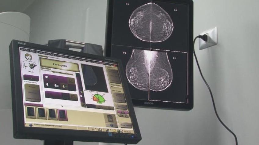 [VIDEO] Examen es clave para detectar cáncer: Alerta por disminución de mamografías en pandemia