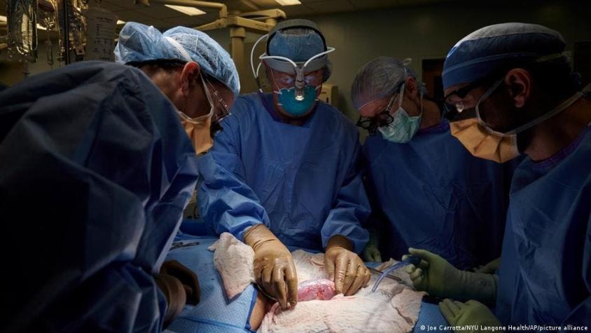 Por primera vez prueban con éxito trasplante de riñón de cerdo en paciente humano