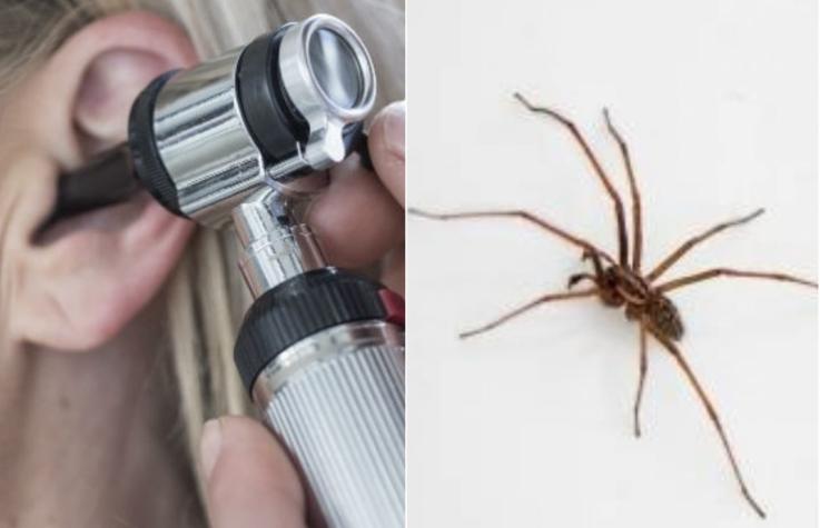 Mujer acude al médico por dolor de oído: Médico encontró una araña en su interior