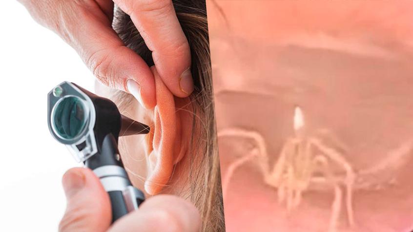 Mujer fue al médico por dolor de oído y encontraron una araña viva dentro de ella