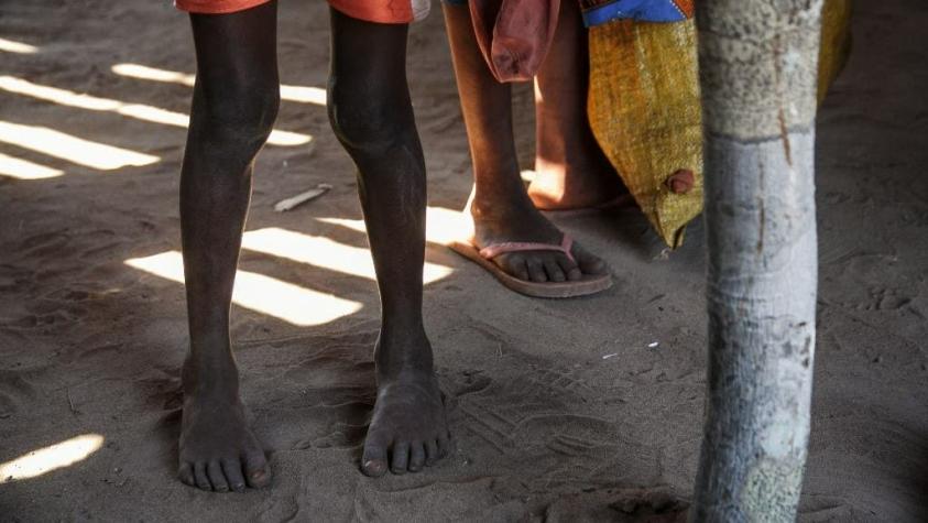 Madagascar, la primera víctima de la hambruna por el calentamiento global causado por los humanos