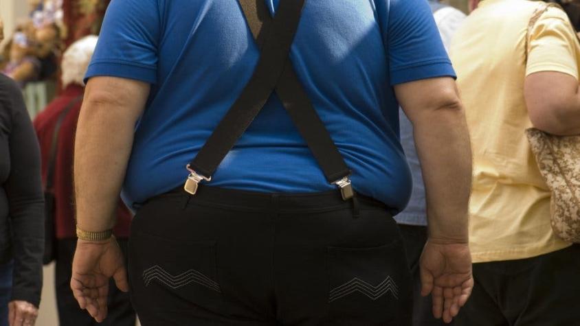Los 4 tipos de obesidad según la Clínica Mayo (y por qué es importante categorizarlos)