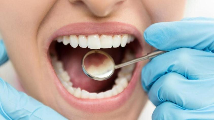 Chilenos desarrollan prometedor medicamento para prevenir aparición y desarrollo de caries