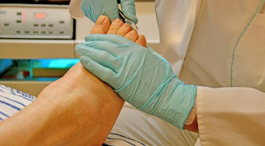 Por utensilios sucios: Mujer asiste a una sesión de pedicura y termina con una pierna amputada