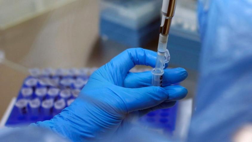 Coronavirus en Chile: 4.380 casos nuevos, la mayor cifra desde junio de 2021