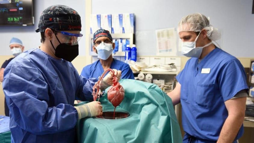 3 cuestiones éticas en torno a los trasplantes de corazón de cerdo en humanos