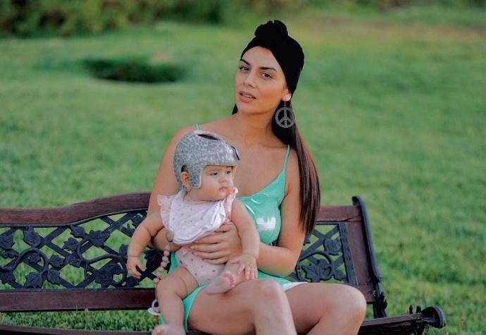 Las razones médicas por las que la bebé de Kathy Contreras usa casco