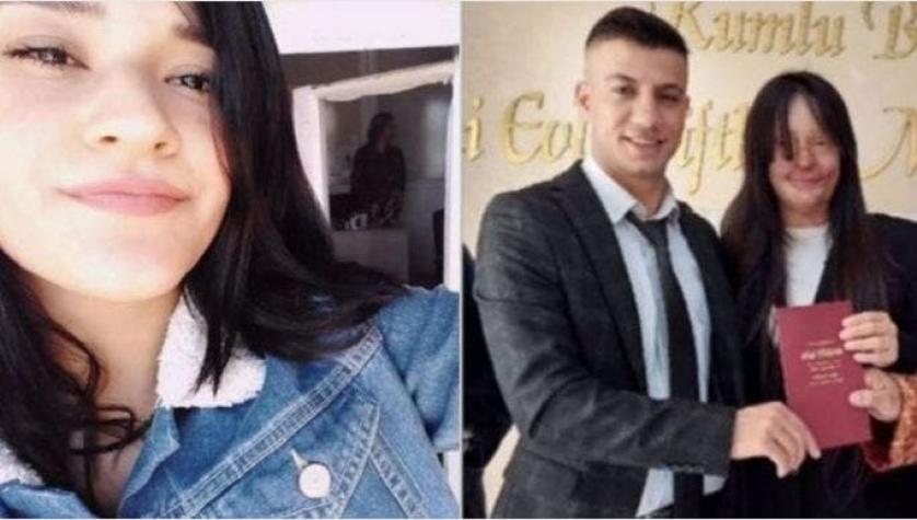 Mujer se casó con el hombre que le lanzó ácido en la cara en Turquía