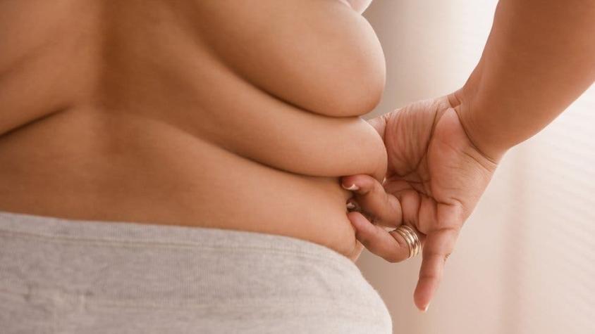 Covid: por qué acumular grasa corporal nos hace más vulnerables al coronavirus