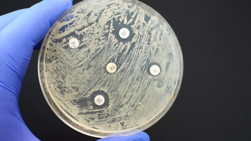 "Pandemia silenciosa": las infecciones resistentes a antibióticos matan más personas que la malaria