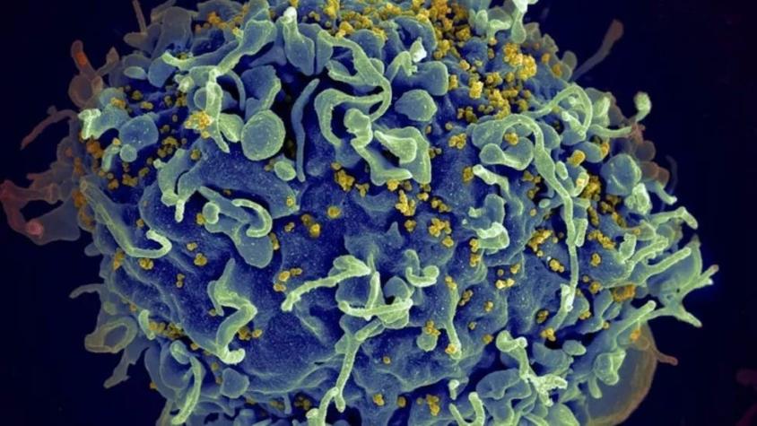 El estudio que detectó una mutación más virulenta del VIH (y por qué no debe alarmarnos)