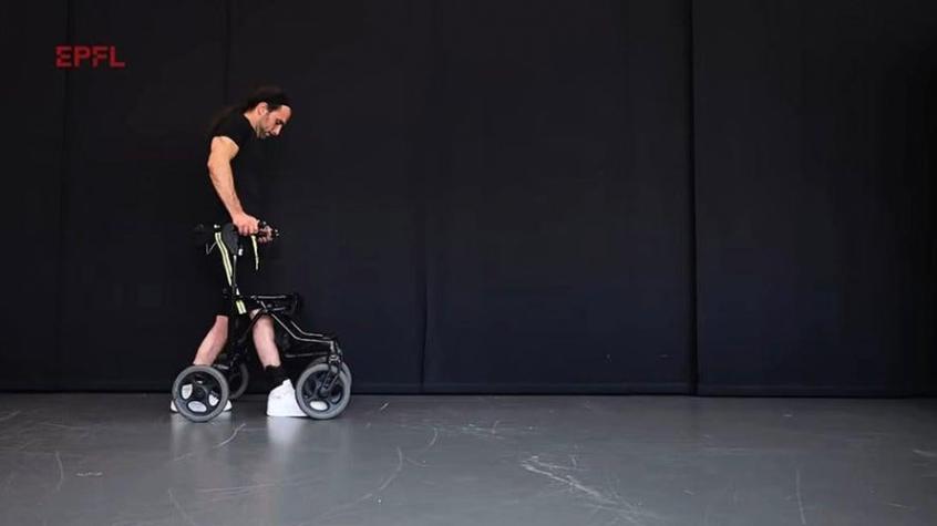Tres parapléjicos volvieron a caminar gracias a implantes de médula espinal