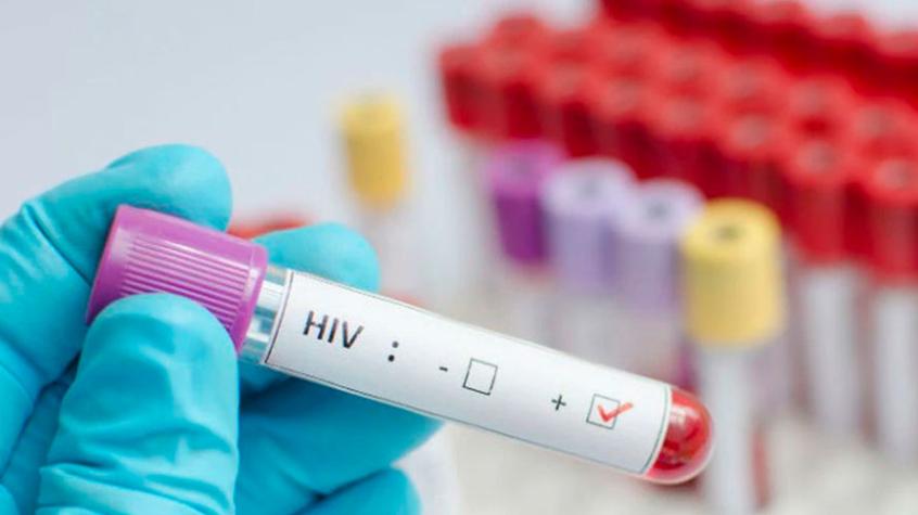 Científicos habrían curado por primera vez el VIH en una mujer