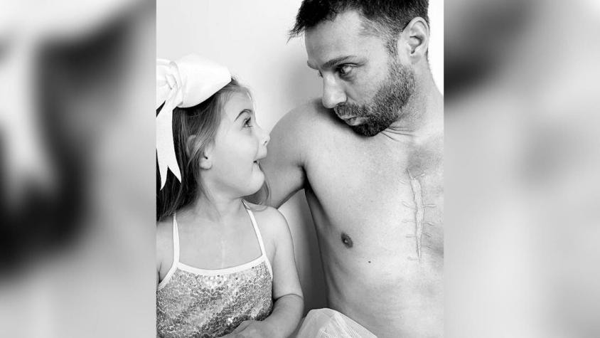 Padre se tatúa la cicatriz que tiene su hija de 4 años en el pecho por cirugías a corazón abierto