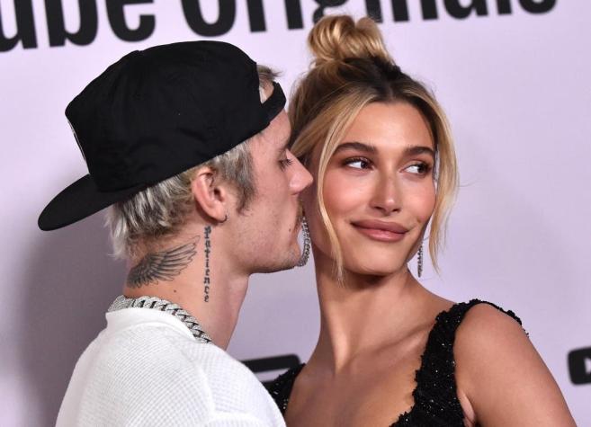 Modelo Hailey Bieber fue hospitalizada por un "padecimiento cerebral"