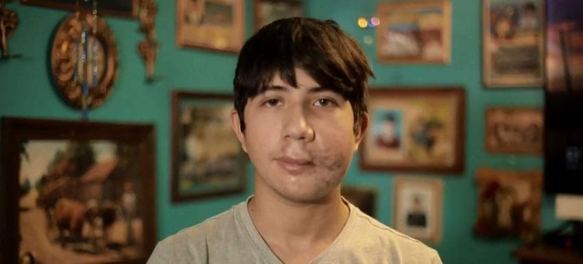 [VIDEO] Habla joven camionero baleado en la cara en La Araucanía