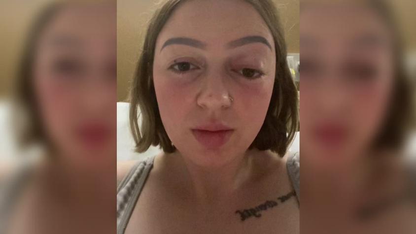 "Nunca había visto algo así": Mujer hizo tanta fuerza en el parto que se le salió un ojo