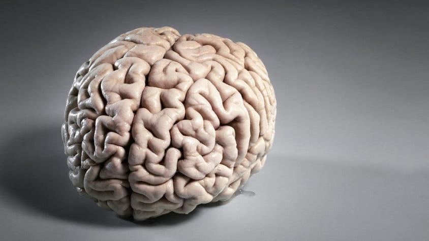Qué es la materia blanca que compone la mitad de nuestro cerebro