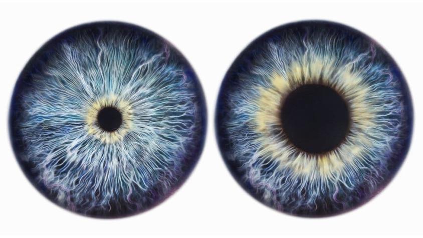 Lo que tus ojos pueden revelar de tu salud