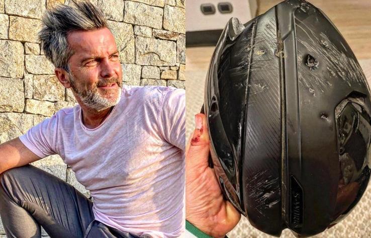 "El casco salva vidas": Cristián Sánchez sufrió fuerte caída en bicicleta y quedó con grave fractura