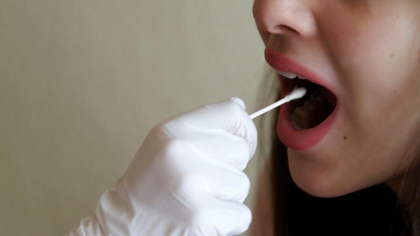 Mujer debió ser operada de urgencia tras tragarse hisopo de un test para COVID-19 Mujer debió ser operada de urgencia tras tragarse hisopo de un test para COVID-19