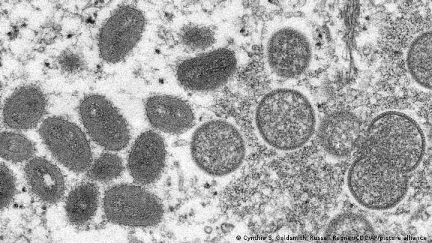 Viruela del mono: ECDC sugiere vacunar a contactos de riesgo de infectados