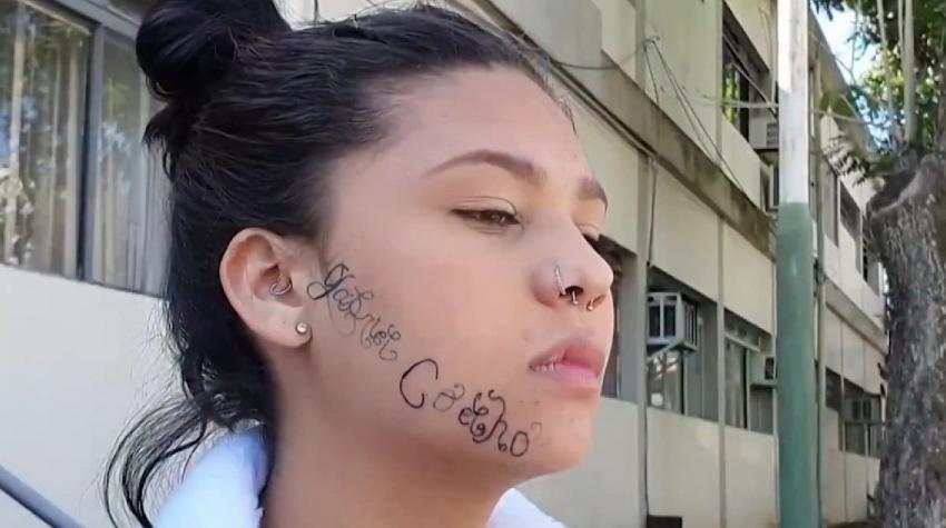 Joven denunció que su ex pareja le tatuó su nombre en la cara para marcarla como de "su propiedad"