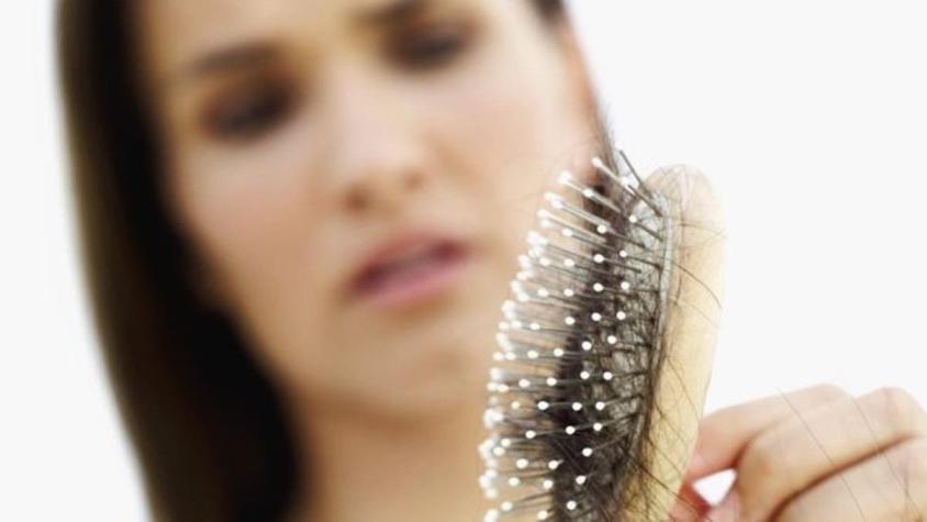 Fármaco contra la alopecia obtiene buenos resultados: se podría recuperar más del 80% del cabello