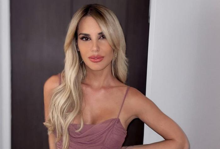 Gala Caldirola sacó aplausos al mostrarse sin maquillaje en redes sociales: "Sencillamente bella"