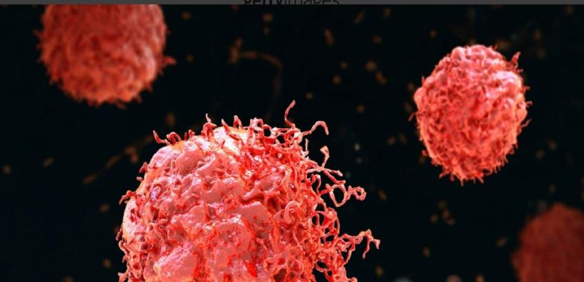Fármaco logró eliminar avanzado cáncer de colon al 100% de pacientes que participaron en estudio
