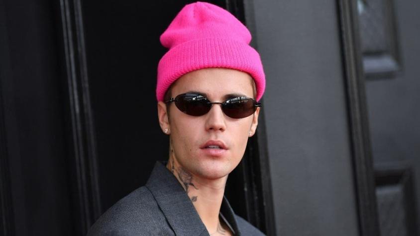 Justin Bieber revela que padece extraño síndrome que paralizó la mitad de su rostro