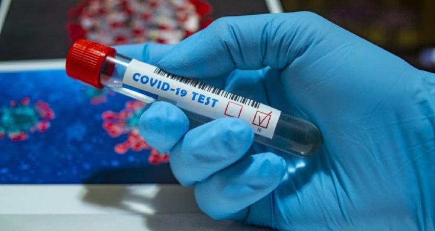Casos siguen al alza: Chile reporta 11.754 nuevos contagios de COVID-19 este jueves
