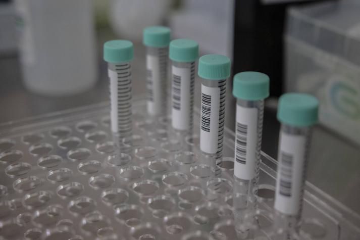 Viruela del mono: Conoce cómo funciona el examen PCR que se implementará en Chile para detectar contagios