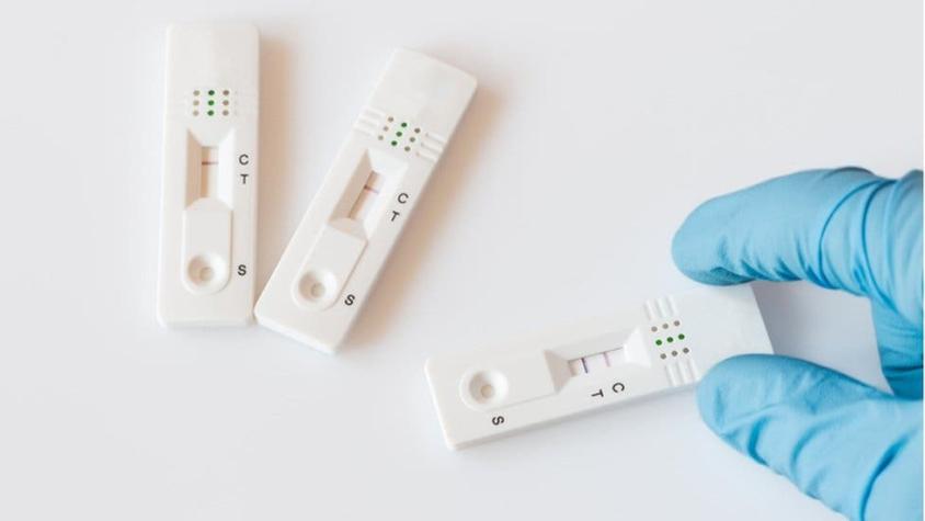Pruebas para covid: qué explica que haya tantos resultados negativos entre infectados