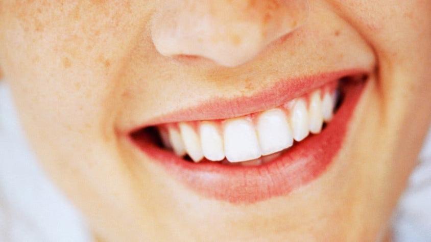 Periodontitis: el problema en las encías que puede afectar tu salud mucho más allá de tu boca