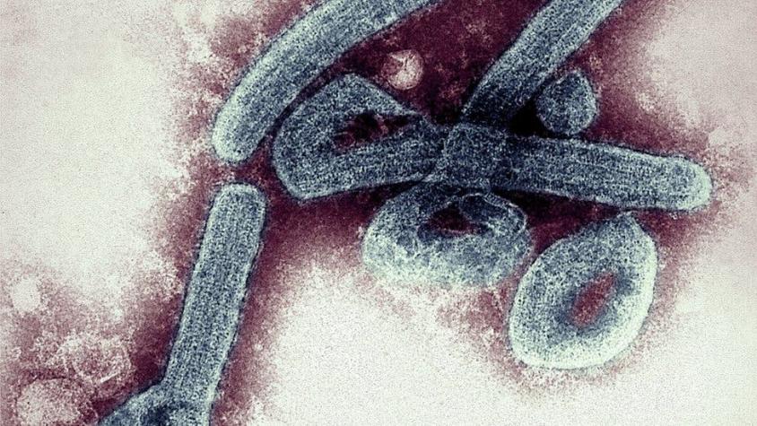 Ghana: Preocupación por primer brote del mortal virus de Marburgo, de la misma familia que el ébola