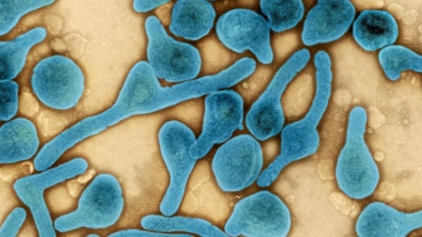 Virus de Marburgo: qué es, cómo se trasmite y cómo prevenir la enfermedad infecciosa