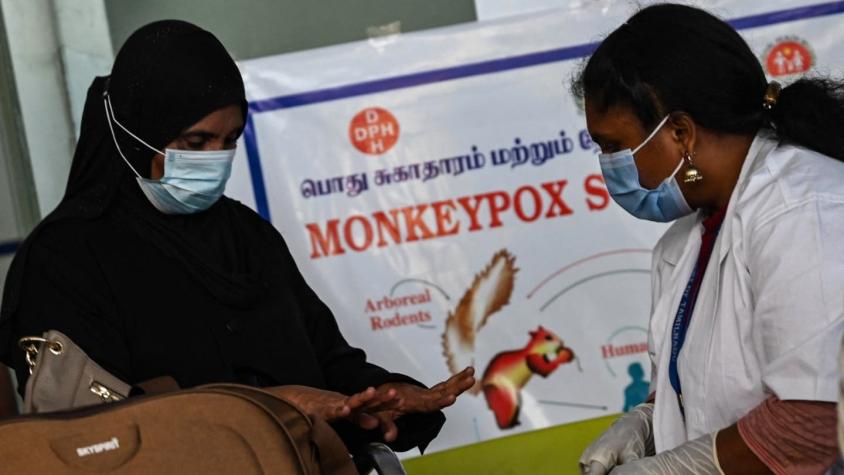 Estados Unidos reporta los dos primeros casos de viruela del mono en niños