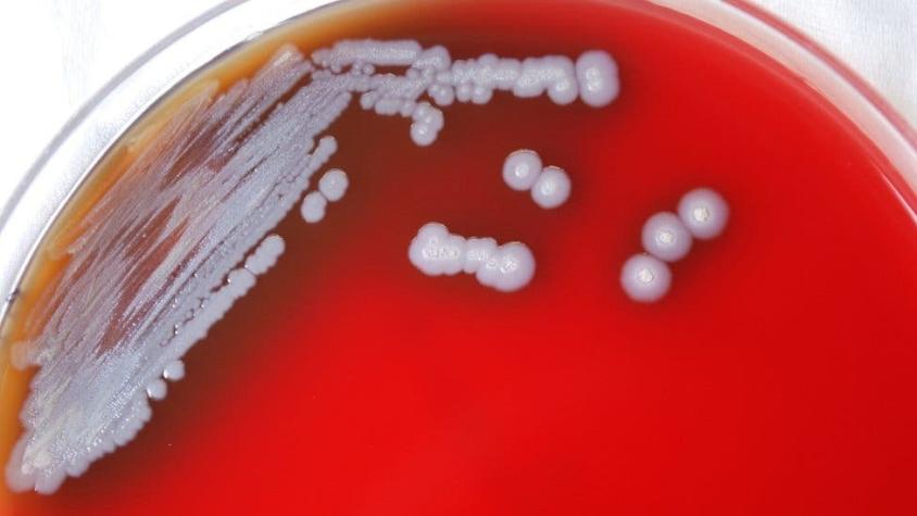 La peligrosa bacteria encontrada en EE.UU. que preocupa a las autoridades de salud del país