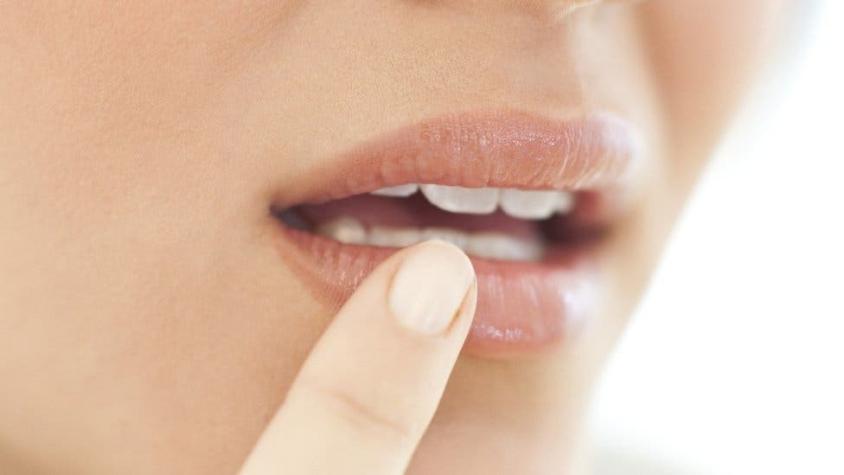 La investigación que vincula el herpes labial con los besos en la Edad de Bronce