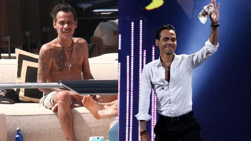 Marc Anthony preocupa a sus seguidores por su extrema delgadez