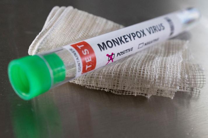 Se elevan los casos de viruela del mono en Chile