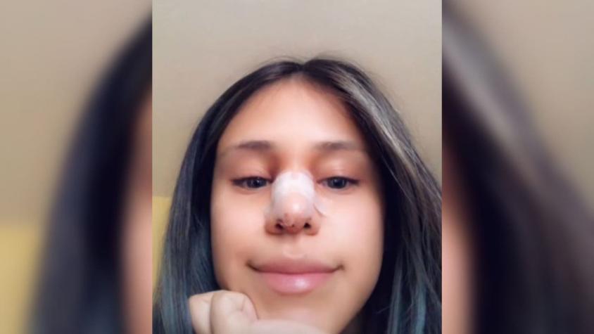 Viral en TikTok: Joven perdonó infidelidad de su novio a cambio de una cirugía estética