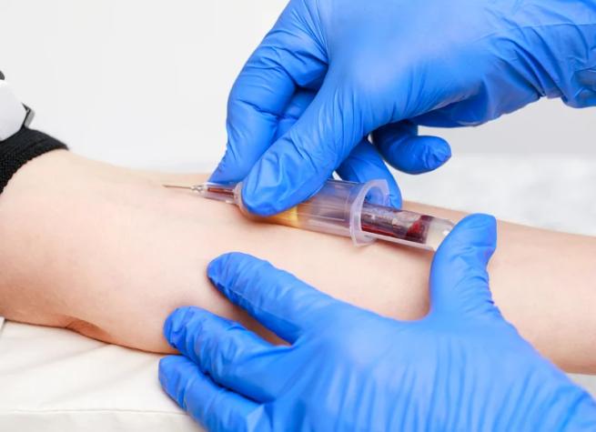 Examen de sangre promete detectar cáncer antes de aparición de síntomas