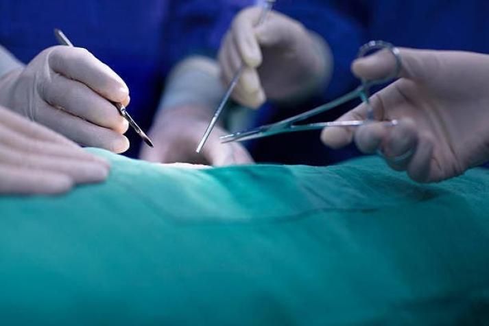 Se necesitaron a 14 personas en el quirófano: Extirpan tumor de 46 kilos a mujer en Brasil